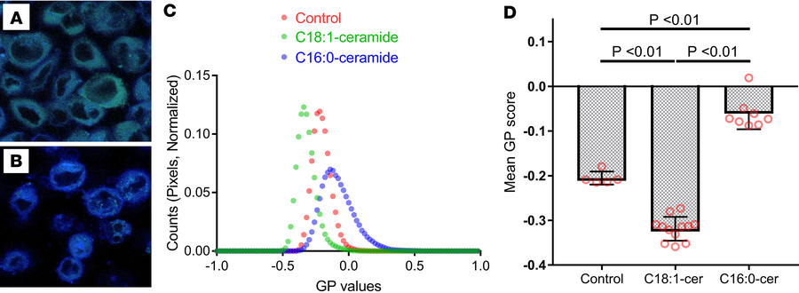 C16:0 ceramide causes ER membrane phase transition to a more ordered sta...