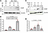 ER stress with in vitro and in vivo models.