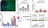 In vivo and in vitro models are associated with decreased LD biogenesis.