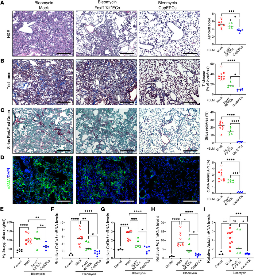Transplantation of capEPCs attenuates fibrotic remodeling in bleomycin-t...