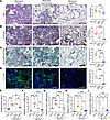 Transplantation of capEPCs attenuates fibrotic remodeling in bleomycin-trea