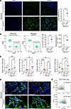 Transplantation of capEPCs increases the number of lung ECs in bleomycin-in