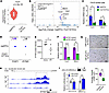 Ifitm3 is a direct transcriptional target of FOXF1.