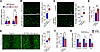 IFITM3 promotes EC functions but inhibits fibroblast activation.
