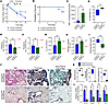 Treatment with IFITM3-containing exosomes decreases PF and improves surviva