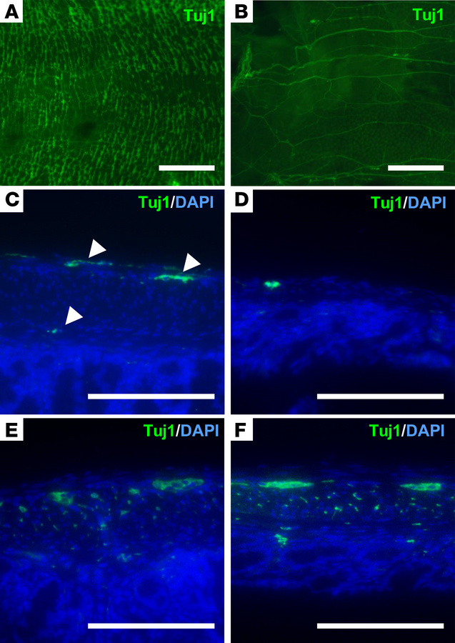 Reduced ganglion and neuronal density in the distal colon of HSCR mice.
...