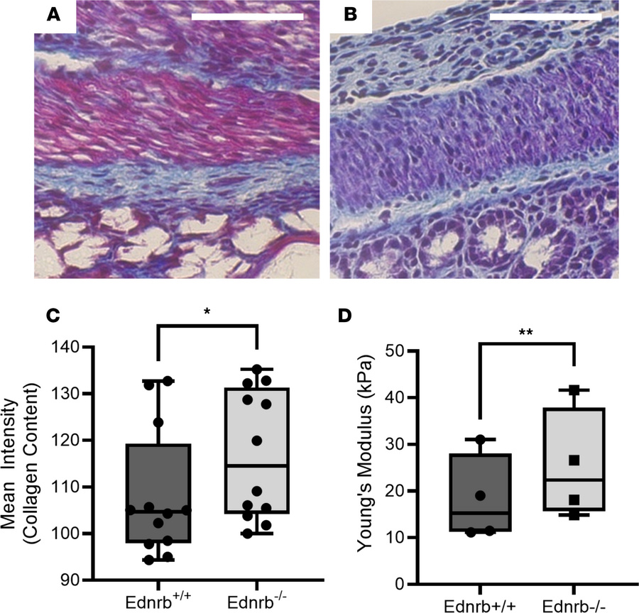 HSCR mice have stiff and fibrotic proximal ganglionic colon.
(A and B) R...