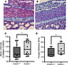 HSCR mice have stiff and fibrotic proximal ganglionic colon.