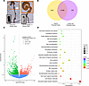 Differential gene expression in proximal ganglionic colon.