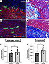 Patients with HSCR have increased fibrosis in ganglionic intestine.