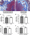 No difference in fibrosis in age-matched HSCR, ARM, and patients with intes