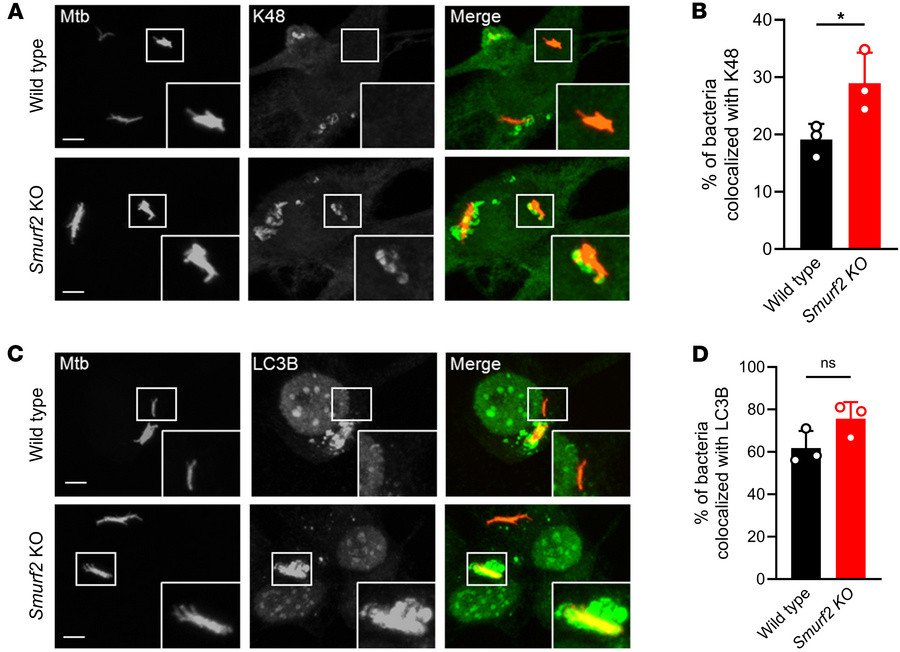 K48 and LC3B colocalize with M. tuberculosis in murine macrophages lacki...