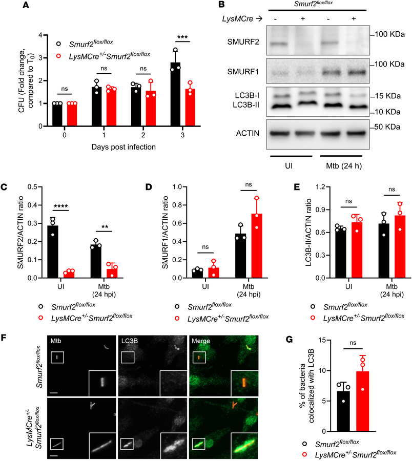 
LysMCre+/–Smurf2fl/fl murine macrophages are more resistant to M. tuber...