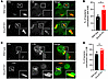 K48 and LC3B colocalize with M. tuberculosis in murine macrophages lacking