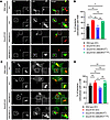 Smurf2 complementation reduces K48 ubiquitin and LC3B colocalization with M