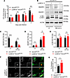 LysMCre+/–Smurf2fl/fl murine macrophages are more resistant to M. tuberculo