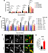 Inhibition of SMURF2 by Heclin reduces M. tuberculosis intracellular growth
