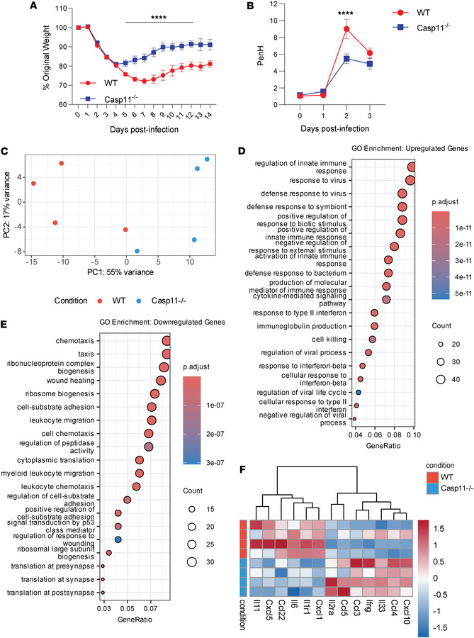 CASP11 deficiency protects against severe SARS-CoV-2 infection, limits e...