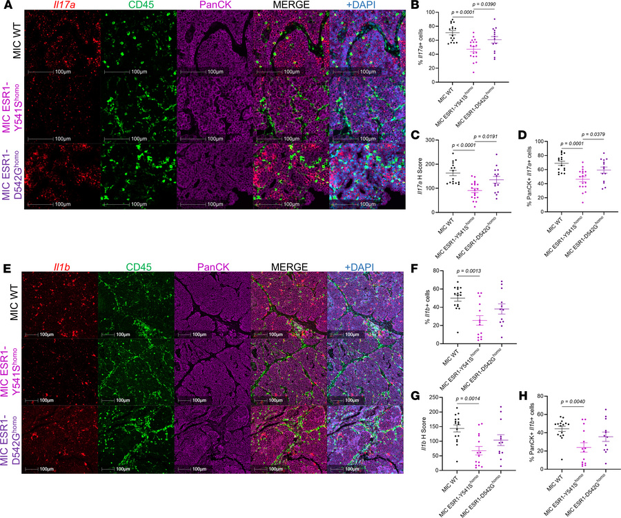 
Il17a and Il1b are decreased in MIC ESR1-Y541Shomo endpoint mammary tum...