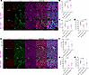Il17a and Il1b are decreased in MIC ESR1-Y541Shomo endpoint mammary tumors.