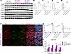 MIC ESR1-Y541Shomo endpoint mammary tumors have increased levels of p-Stat5