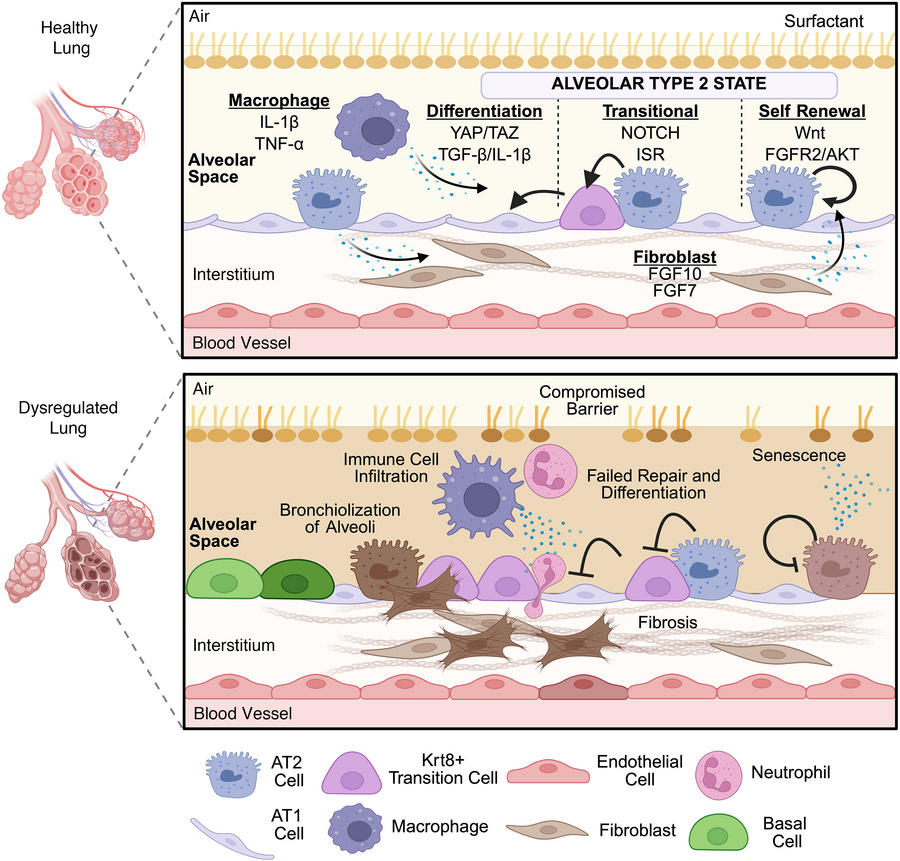 AT2 dysfunction in the lung.
A schematic overview of the main interactio...