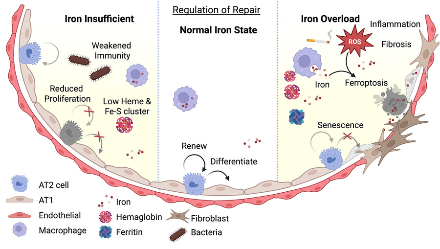 Role of iron regulation in alveolar repair.
A schematic illustrating how...