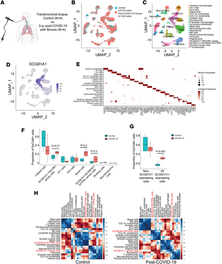 Increased proportions of SCGB1A1-expressing lung cells after severe COVI...