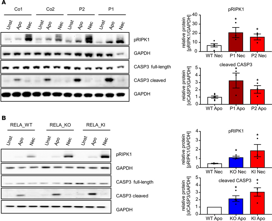 Increased sensitivity to apoptosis and necroptosis conferred by the RELA...