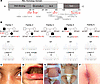 Genetic and clinical findings in patients with truncating RELA variants.