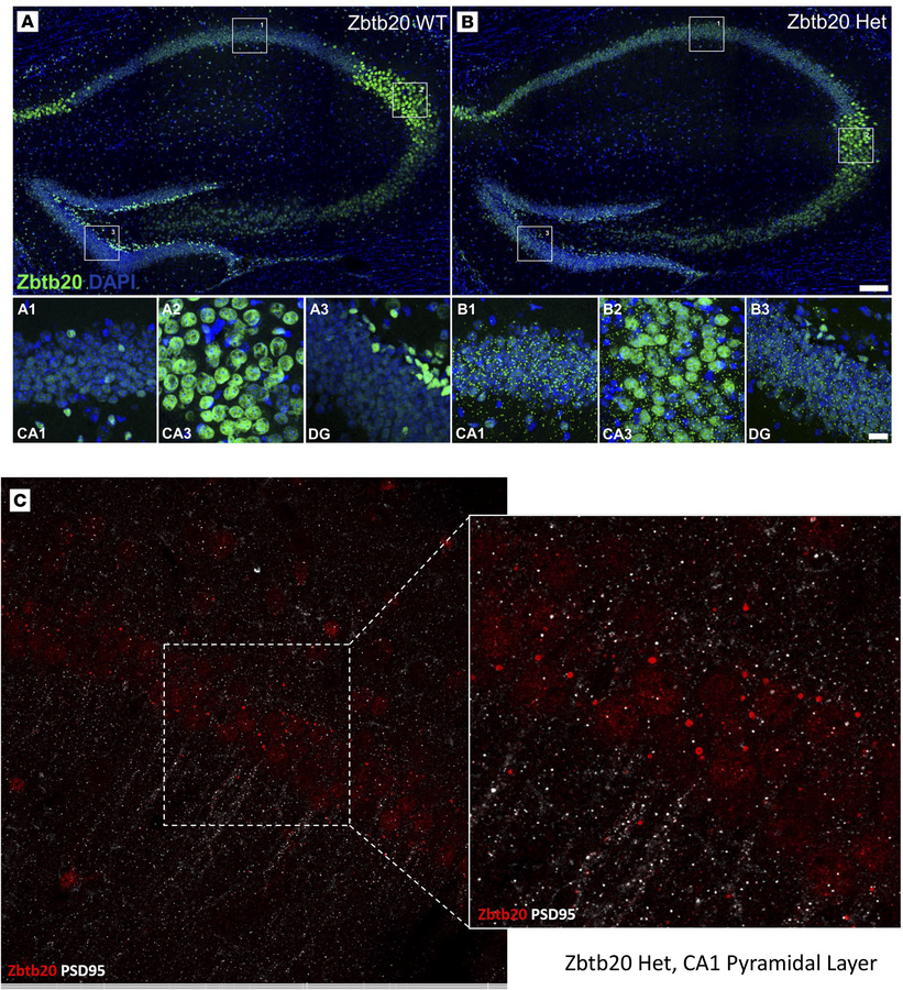 Histology.
(A and B) Representative images of ZBTB20 expression (green) ...