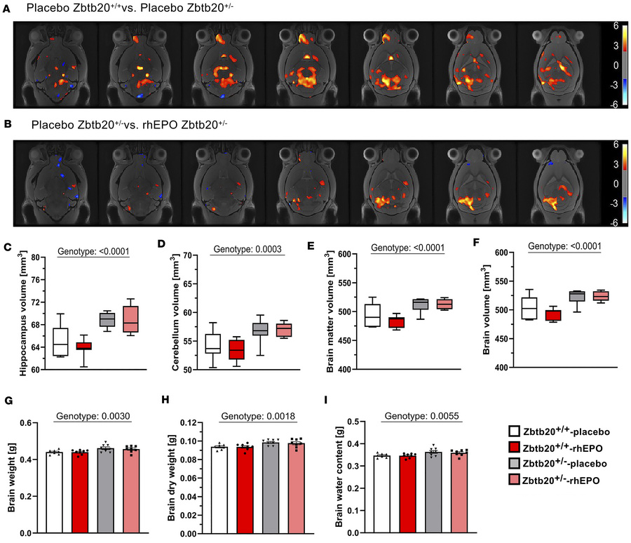 Magnetic resonance imaging.
(A and B) Voxel-wise Jacobian determinants m...