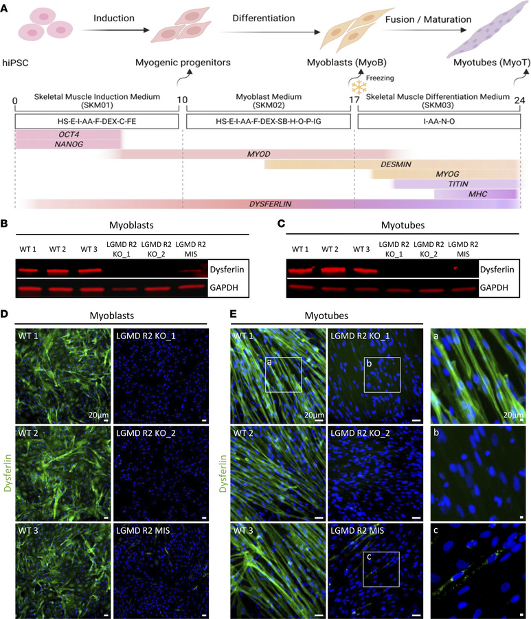 Phenotypic features of LGMD R2 hiPSC-derived skeletal muscle cells revea...
