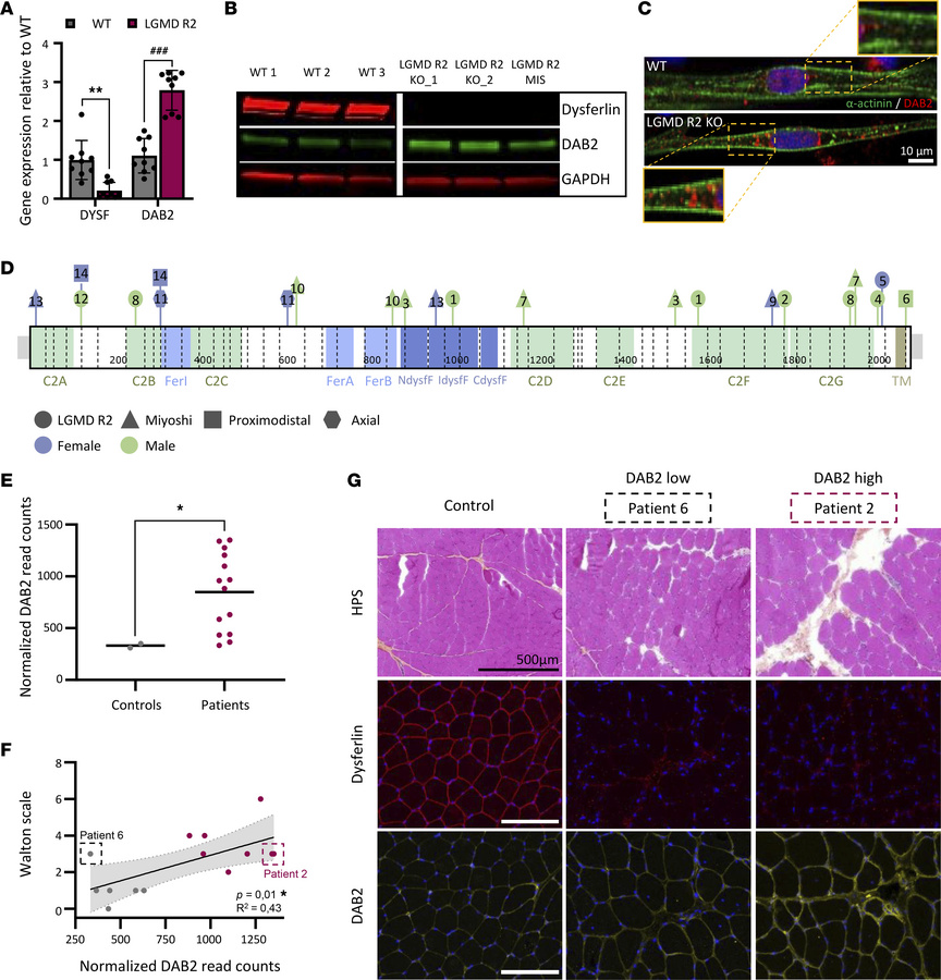 Dysregulation of Disabled-2 (DAB2) in human dysferlin-deficient myotubes...