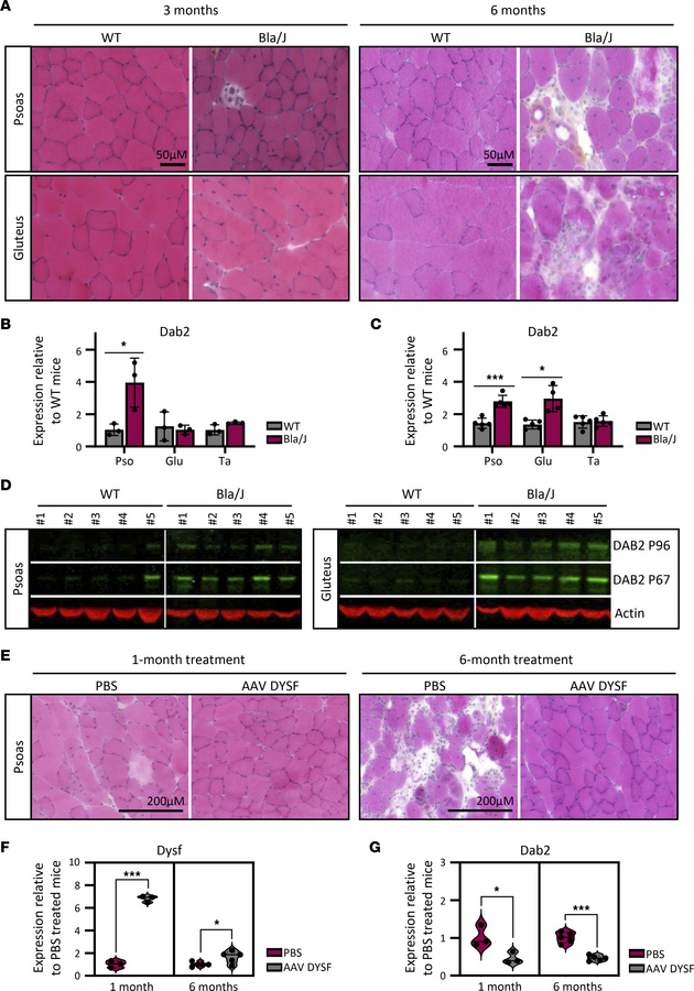 DAB2 is upregulated in severely affected muscles of dysferlin-deficient ...