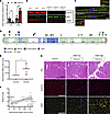 Dysregulation of Disabled-2 (DAB2) in human dysferlin-deficient myotubes an