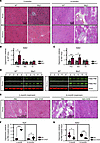 DAB2 is upregulated in severely affected muscles of dysferlin-deficient mic