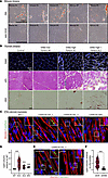 DAB2 expression is associated with lipid accumulation in dysferlin-deficien