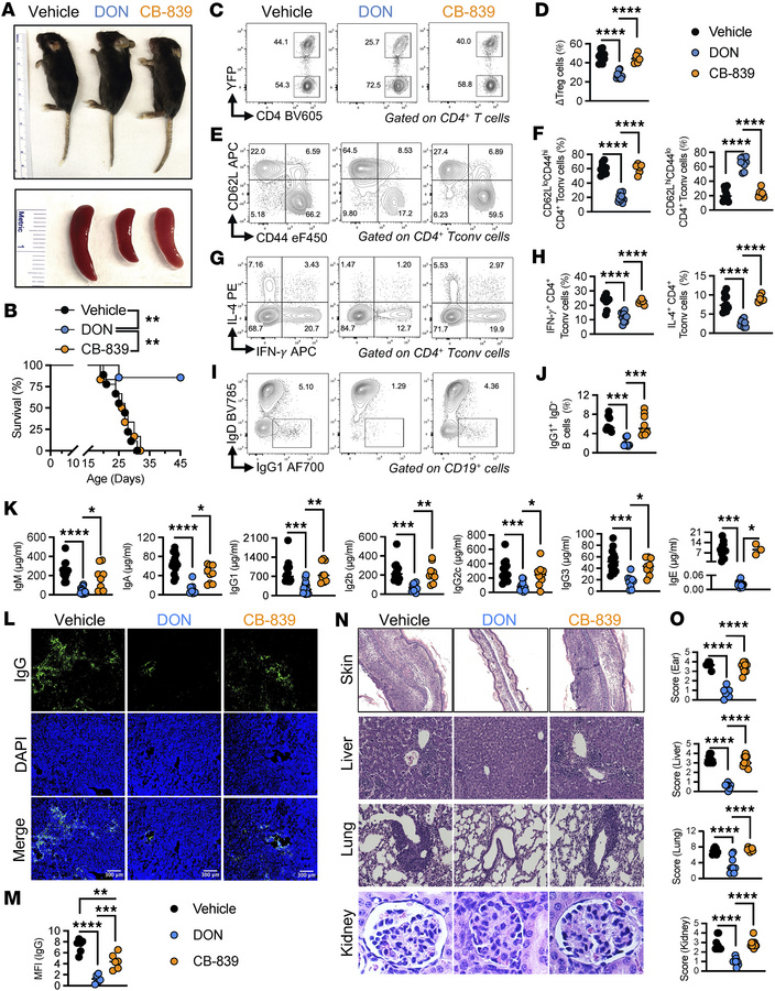Glutamine-dependent biosynthetic pathways contribute to Foxp3 deficiency...