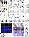 Glutamine-dependent biosynthetic pathways contribute to Foxp3 deficiency–me