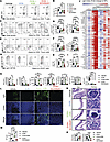 Inhibition of glutamine usage controls activation of autoreactive T and B c