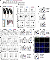 Asparagine exclusively controls B cell dysregulation in Foxp3 deficiency–me