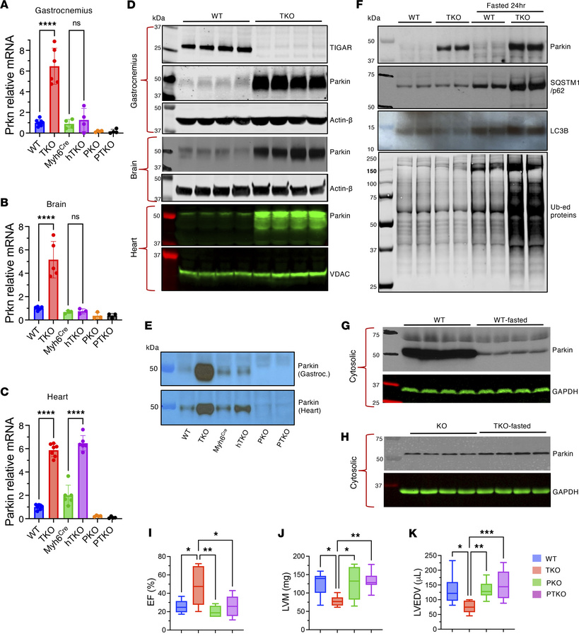 Parkin upregulation mediates cardiac protection in TKO and hTKO mice.
(A...