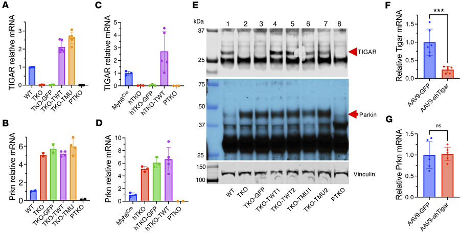 TIGAR expression in adult hearts does not directly affect Parkin express...