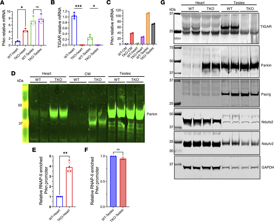 Tissue-specific regulation of TIGAR and Parkin expression in heart and t...