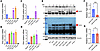 TIGAR expression in adult hearts does not directly affect Parkin expression