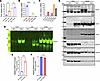 Tissue-specific regulation of TIGAR and Parkin expression in heart and test