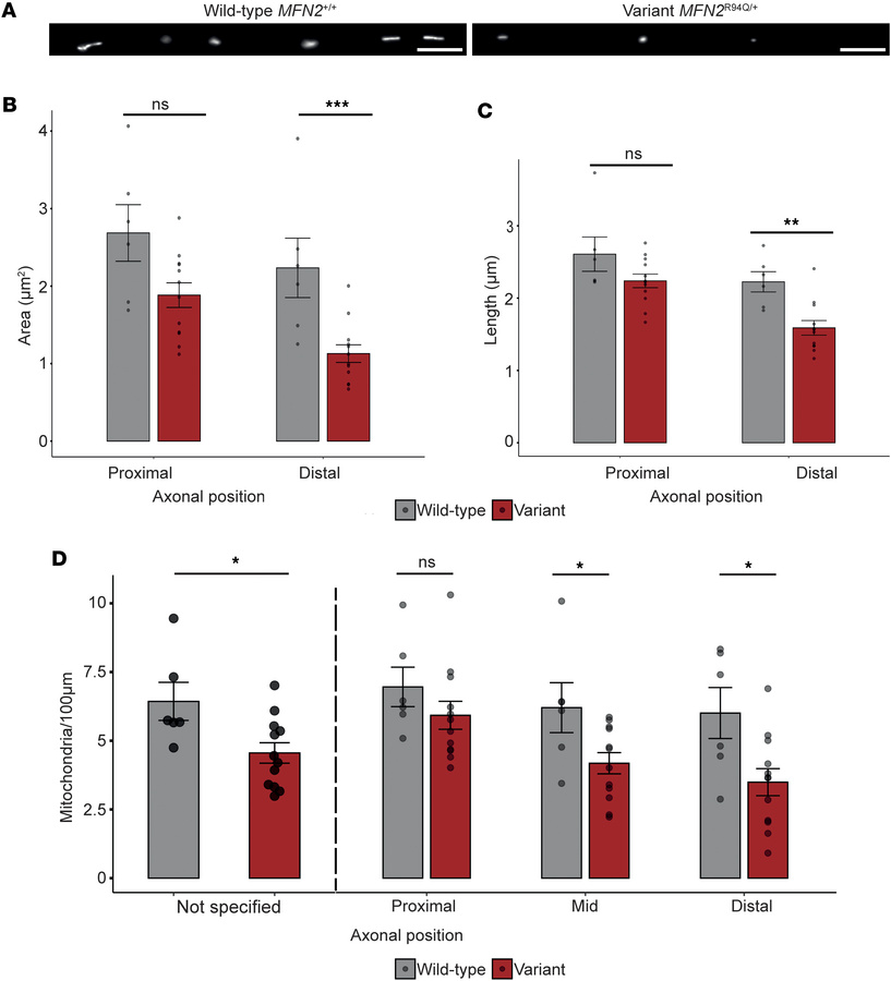 
MFN2R94Q/+ disrupts mitochondrial distribution.
(A) Representative imag...