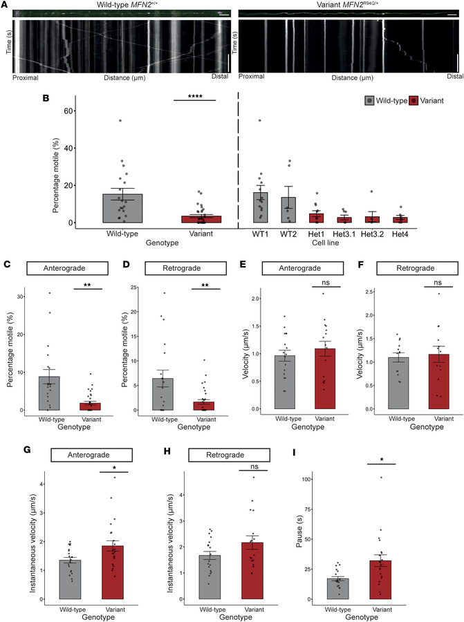 
MFN2R94Q/+ reduces mitochondrial trafficking.
(A) Representative axons ...