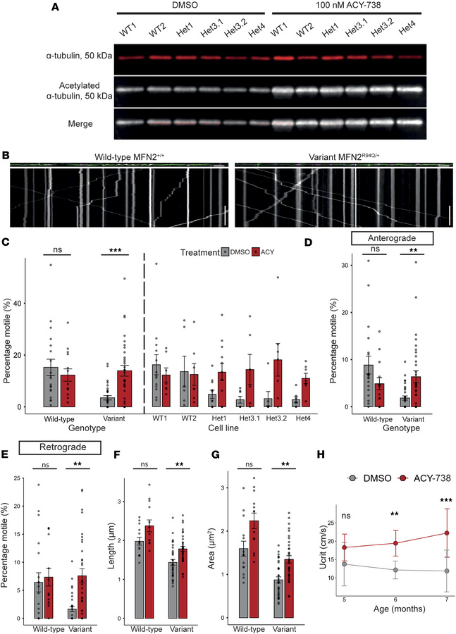 HDAC6 inhibition by ACY-738 partially rescues mitochondrial trafficking ...